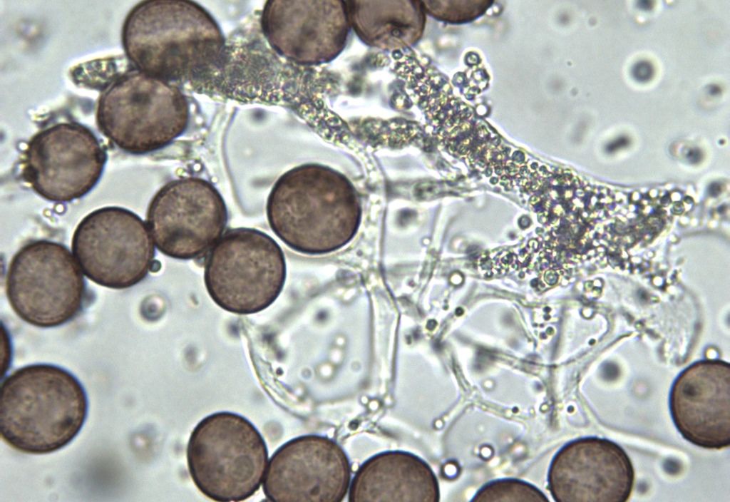 Physarum cf pusillum